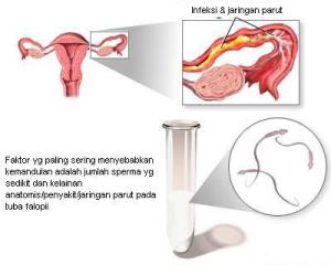 Organ Reproduksi wanita